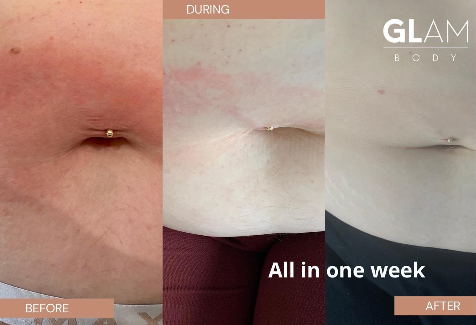 BARE BODY BUTTER - Glam Body