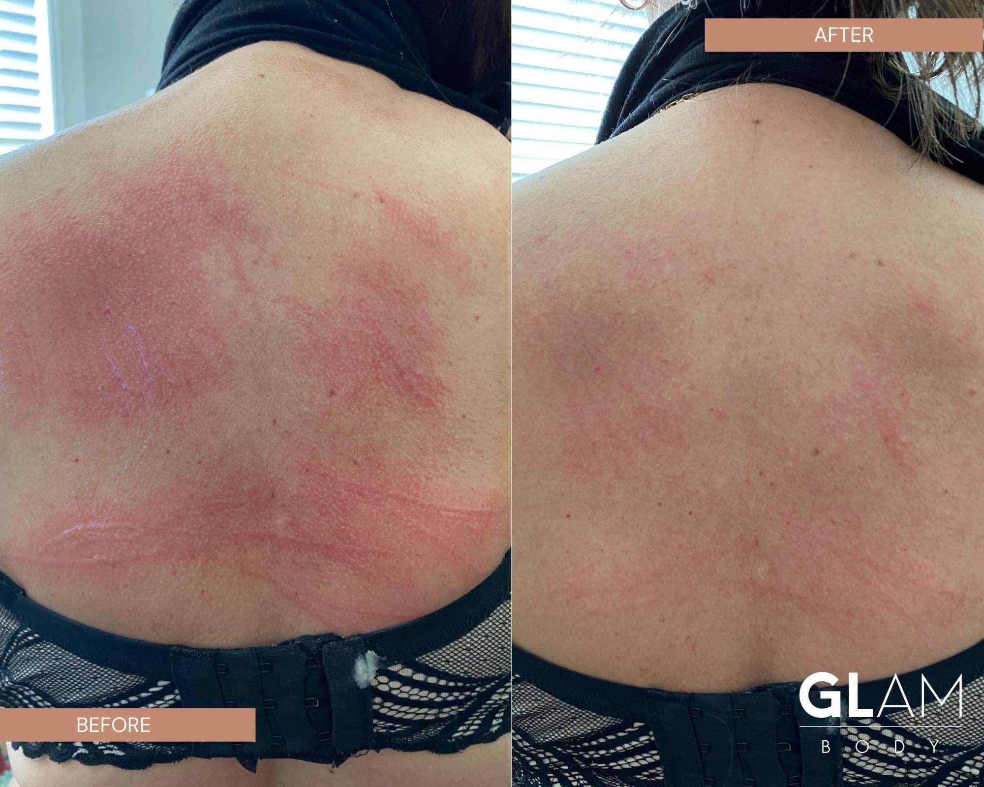 BARE BODY BUTTER - Glam Body