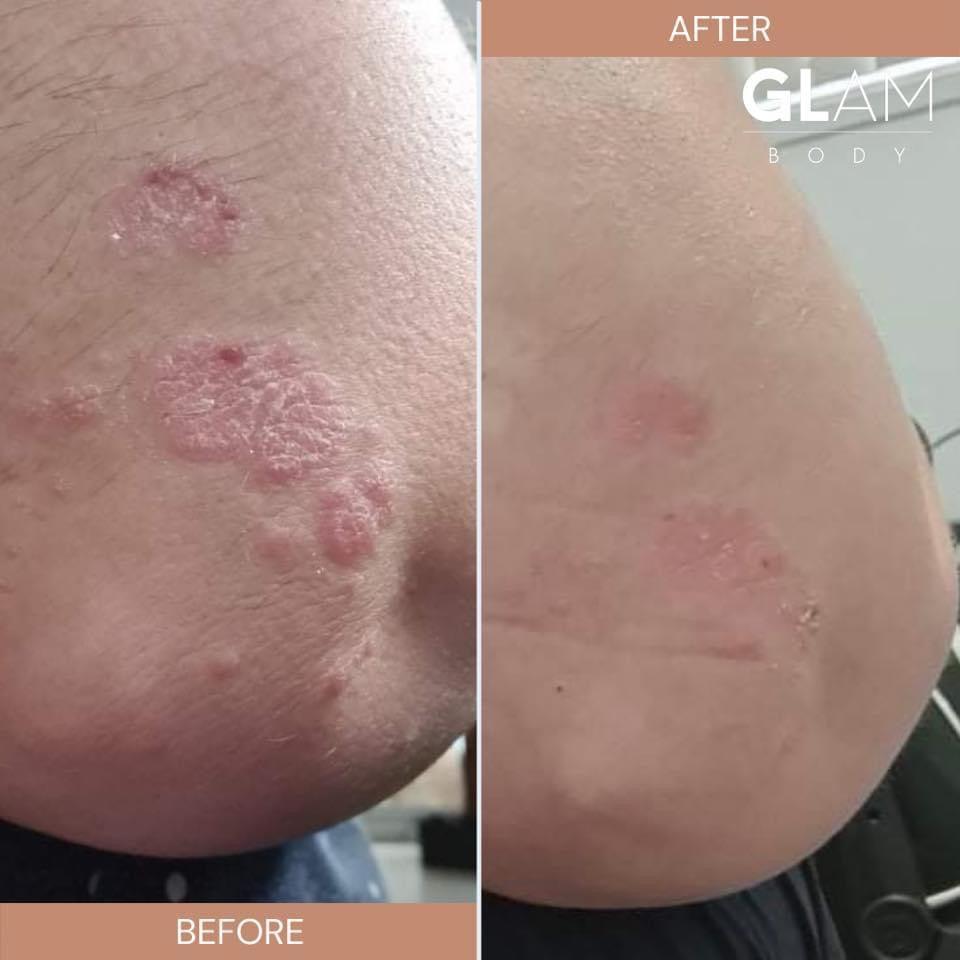 BARE BODY BUTTER - Glam Body