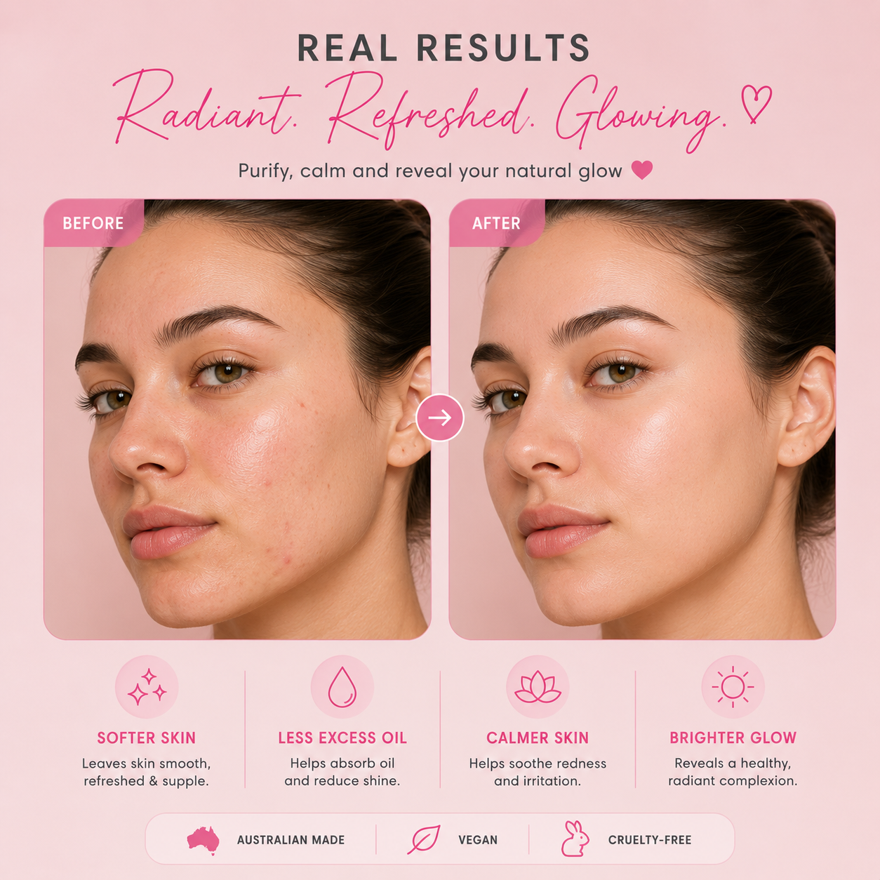 Before and after comparison of a woman's face with text highlighting skin benefits on a pink background.